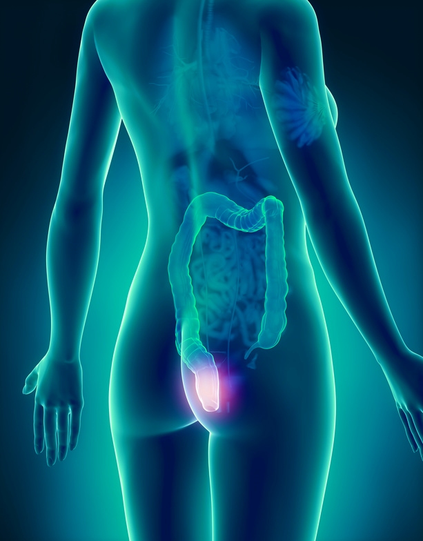 Enddarm-Erkrankungen